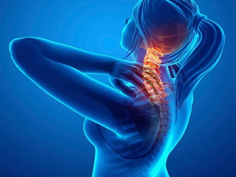 Dor Cervical: Causas, Sintomas e Tratamentos 2025 14 Imagem ilustrativa sobre a Dor Cervical.