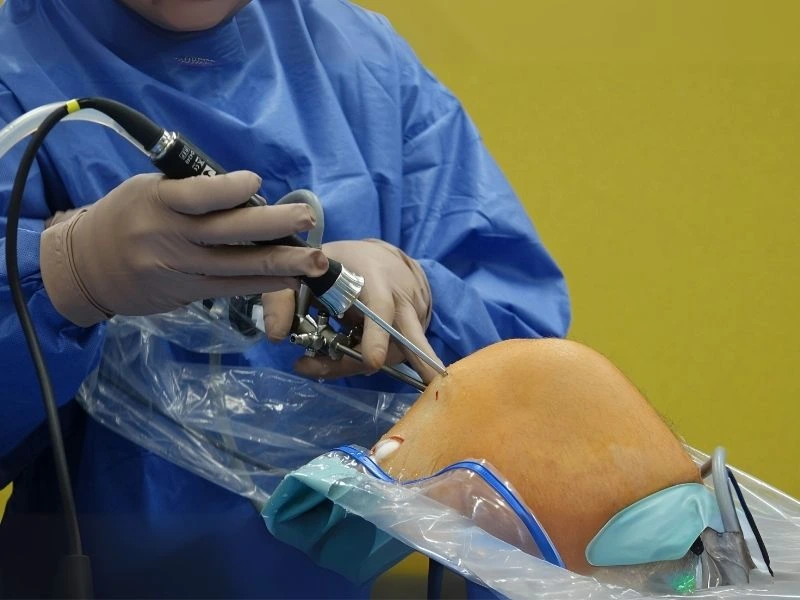 Cirurgia do Ligamento Patelofemoral Medial