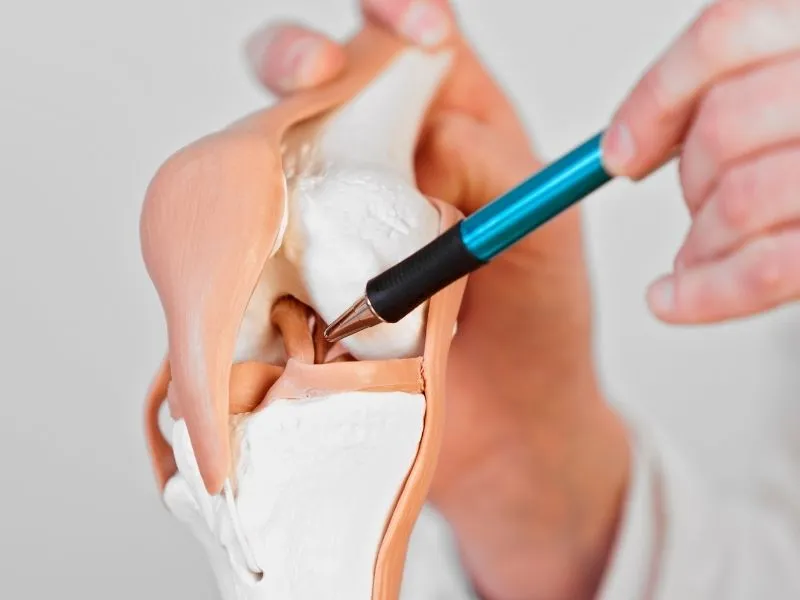 Pré-Operatório LCA: Fisioterapia Reduz 40% das Complicações 4 modelo anatômico do joelho mostrando o ligamento cruzado anterior